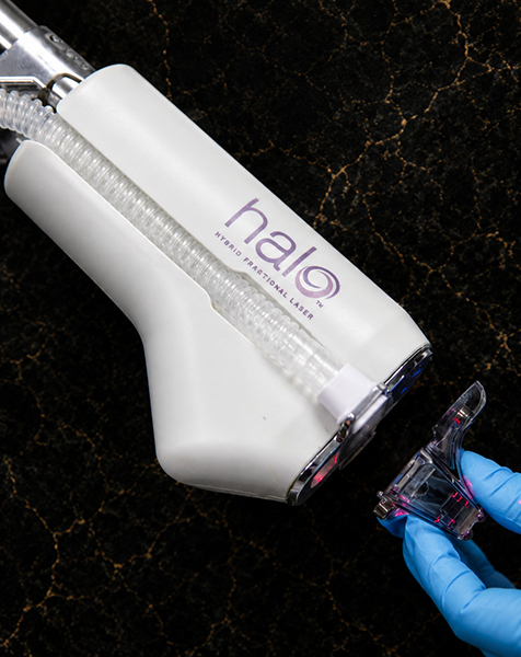 An image of the HALO Laser