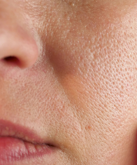 Large Pores