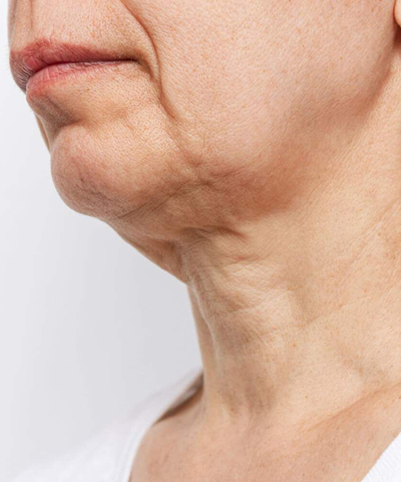 Large Pores